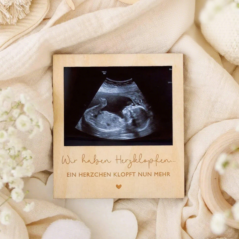 Echografie Zwangerschap Aankon - Photo Booth Frame recensie en prijs